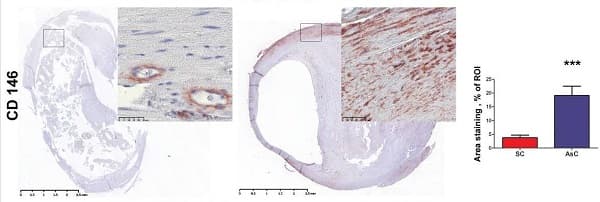 Anti-CD146 antibody [EPR3208](ab75769)