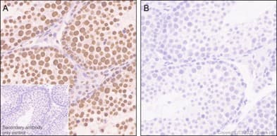 Anti-RNA polymerase II CTD repeat YSPTSPS (phospho S5) antibody [EP1510Y](AB76292)