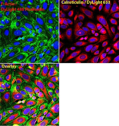 Anti-Calreticulin antibody - ER Marker(AB2907)