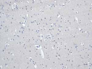 Anti-Desmin antibody [Y66] - Cytoskeleton Marker(AB32362)