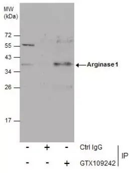 Anti-Liver Arginase antibody(AB96183)
