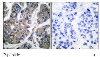 Anti-EEF2/Elongation factor 2 (phospho T56) antibody(AB53114)