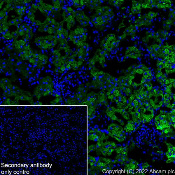 Aquaporin 1 Antibody Epr26554 46 Bsa And Azide Free Ab300464  Immunohistochemistry Frozen Sections Img400588