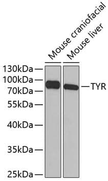 Anti-Tyrosinase antibody(AB180753)