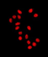 Anti-SUZ12 antibody [EPR5234(N)] - ChIP Grade(AB175187)