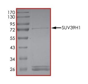 Recombinant human KMT1A / SUV39H1 protein(AB268985)