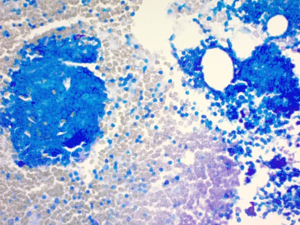 Giemsa Stain Kit Ab150670  Histology Img134870