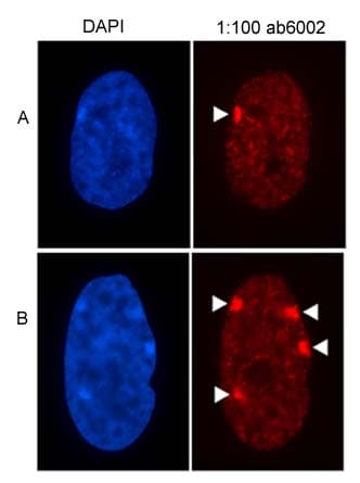 Anti-Histone H3 (tri methyl K27) antibody [mAbcam 6002] - ChIP Grade(AB6002)