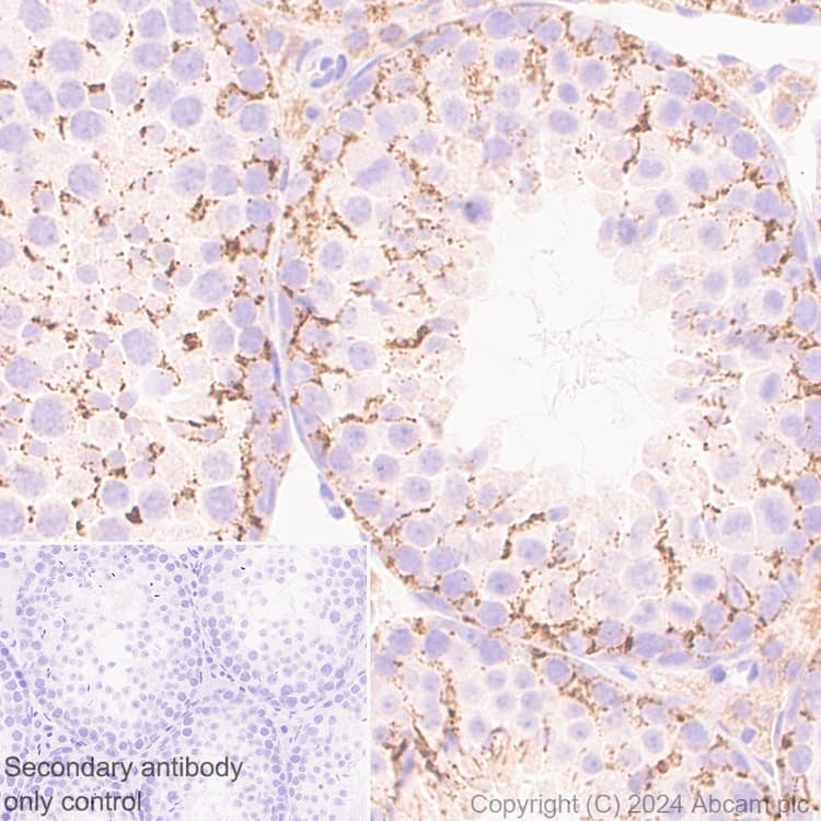 Anti-Slc25a1 antibody [EPR29193-92](AB318201)