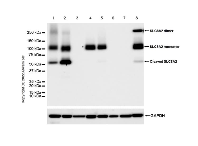 Anti-Sodium/calcium exchanger 2 antibody [EPR25106-37](AB300455)