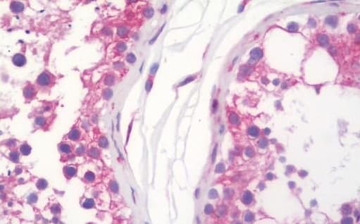 Wfs1 Antibody Ab230512  Immunohistochemistry Formalin Pfa Fixed Paraffin Embedded Sections Img111002
