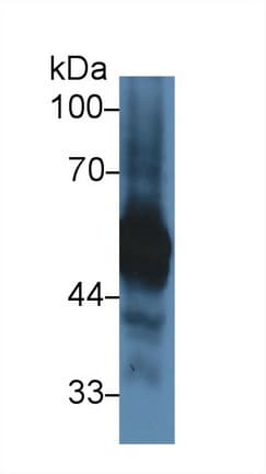 Anti-alpha 1 Antitrypsin antibody(AB231093)
