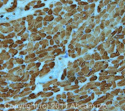 Anti-Cardiac Troponin I antibody(AB47003)