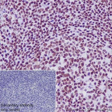 Anti-RNA polymerase II CTD repeat YSPTSPS (phospho S2) antibody(AB5095)