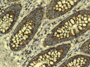 Gc1q R Antibody Epr8870 Ab134926  Immunohistochemistry Formalin Pfa Fixed Paraffin Embedded Sections Img80876