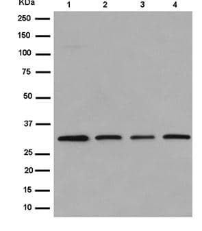 Anti-EXOSC3 antibody [EPR14840(B)] - N-terminal(AB184961)