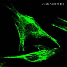 Anti-Desmin antibody - Cytoskeleton Marker(AB15200)