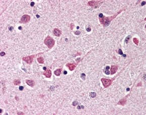 Anti-MAP1 antibody(AB115511)