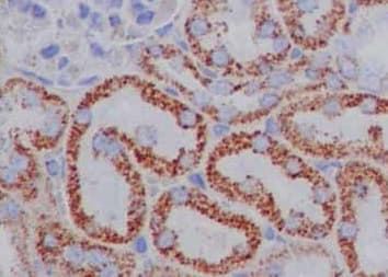 Cd1e Antibody Epr15746b Bsa And Azide Free Ab250917  Immunohistochemistry Formalin Pfa Fixed Paraffin Embedded Sections Img115695