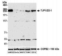 Anti-ZO1 tight junction protein antibody [BLR092G](AB276131)