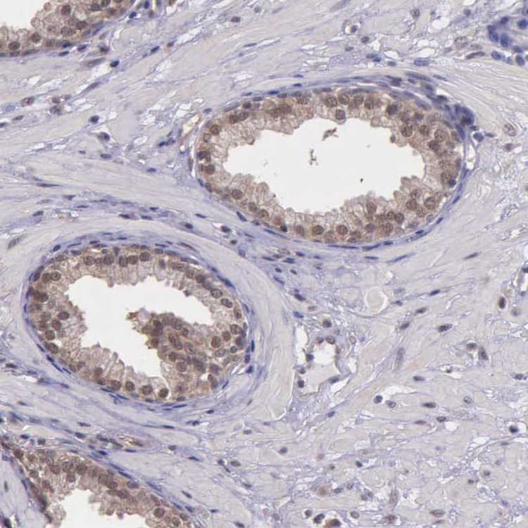 Anti-Proteasome 19S S4/PSMC1 antibody(AB223765)