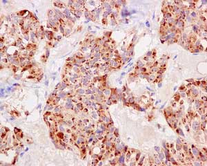 Git1 Antibody Epr10368 Ab171956  Immunohistochemistry Formalin Pfa Fixed Paraffin Embedded Sections Img106543