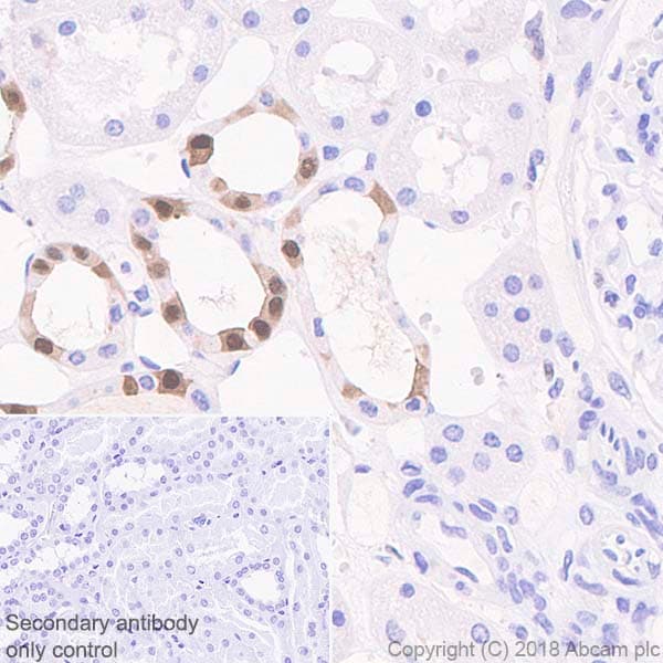 Anti-IL-18 antibody [EPR19954-188](AB243091)