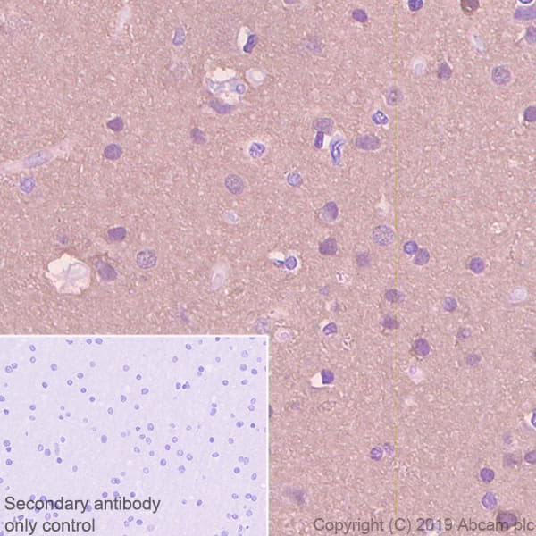 Anti-beta Synuclein antibody [EP1537Y] - BSA and Azide free(AB221908)