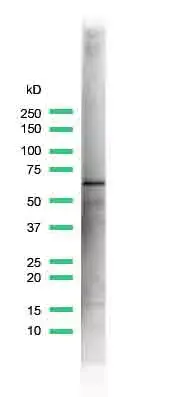 Anti-Estrogen Receptor alpha antibody [SP1](AB16660)