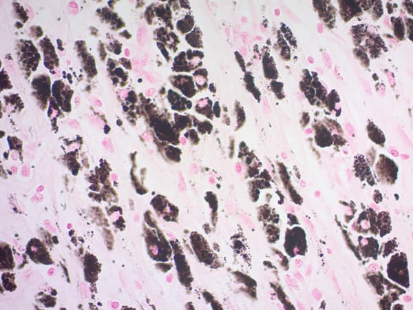 Fontana-Masson Stain Kit (Melanin Stain)(AB150669)