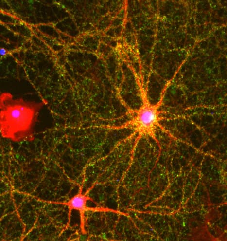 Synaptophysin Antibody Synaptic Marker Ab32594  Immunocytochemistry Immunofluorescence Img39330