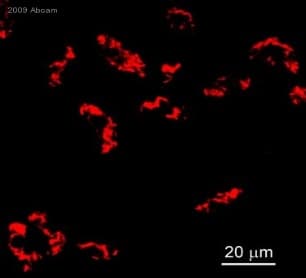 Anti-Desmin antibody - Cytoskeleton Marker(AB15200)
