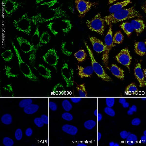 Anti-ATPB antibody [10/ATP](AB289890)