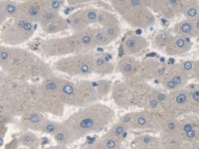 Anti-SMN/Gemin 1 antibody(AB232784)