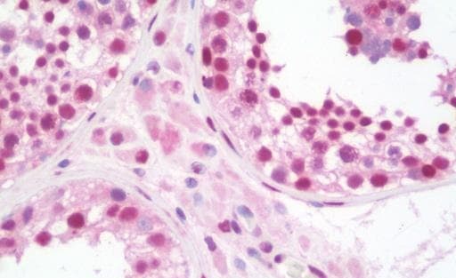 Anti-STAT5 antibody [9F7](AB230670)