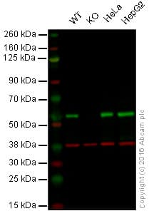 Sqstm1 P62 Antibody Epr18351 Autophagosome Marker Ab207305  Western Blot Img99363