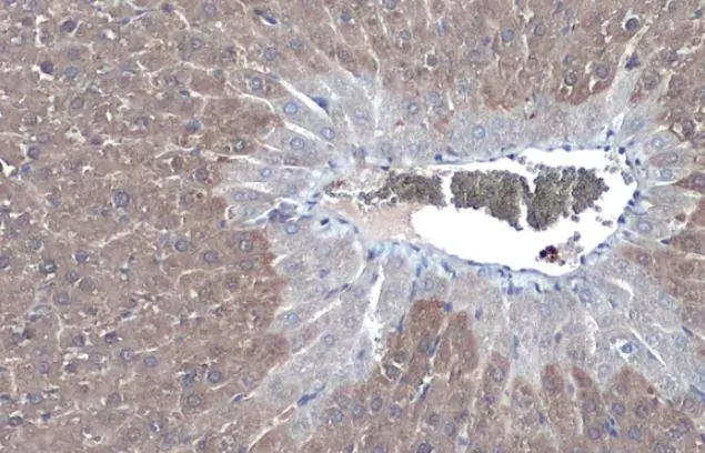 Anti-Liver Arginase antibody(AB96183)