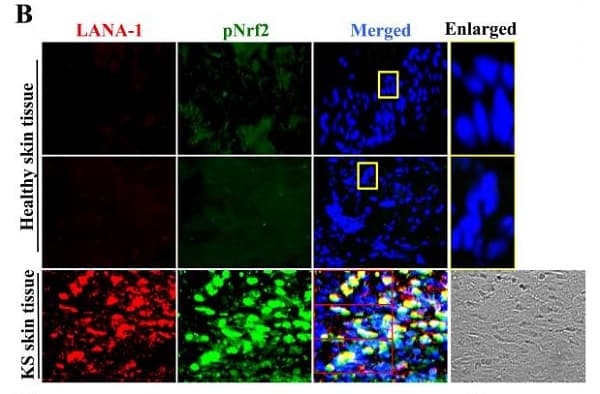 Anti-Nrf2 (phospho S40) antibody [EP1809Y](AB76026)