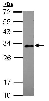 Rab20 Antibody Ab105043  Western Blot Img143210