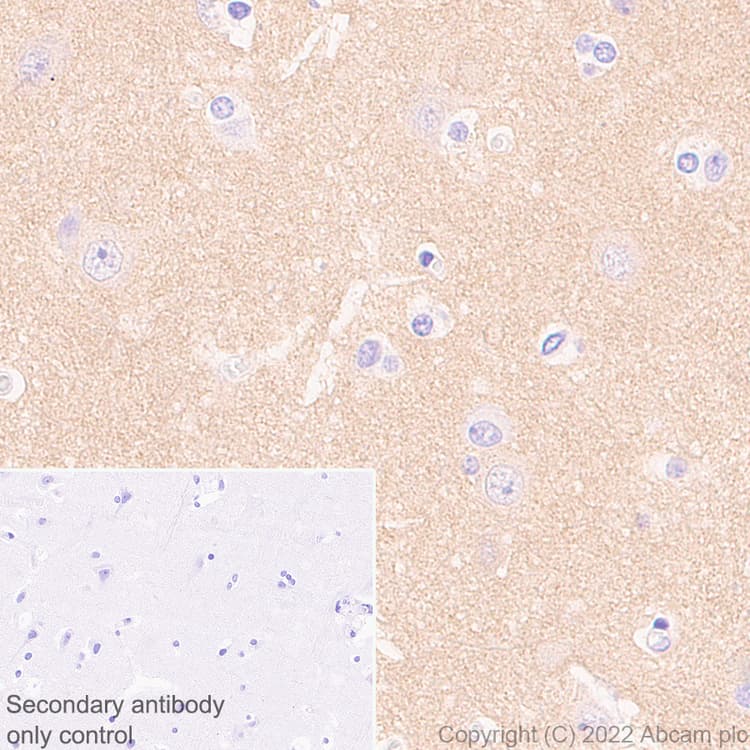 Anti-Calcineurin B/PPP3R1 antibody [EPR24992-18](AB303482)