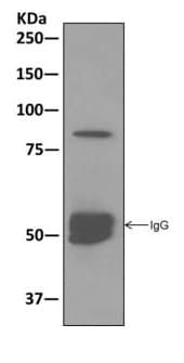 Anti-SUZ12 antibody [EPR5234(N)] - ChIP Grade(AB175187)