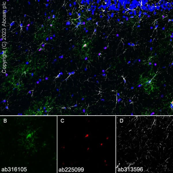 Anti-GPCR GPR17 antibody [EPR26423-34](AB316105)