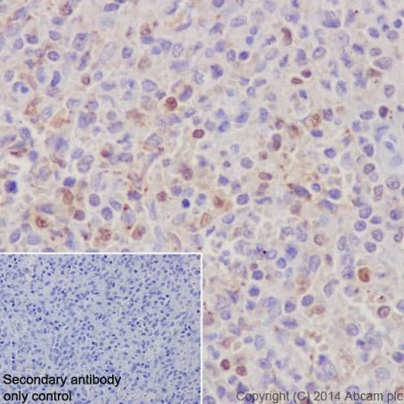 Anti-IRF5 antibody [EPR17067](AB181553)