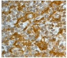 Gelsolin Antibody Ep1940y Bsa And Azide Free Ab284809  Immunohistochemistry Formalin Pfa Fixed Paraffin Embedded Sections Img44580