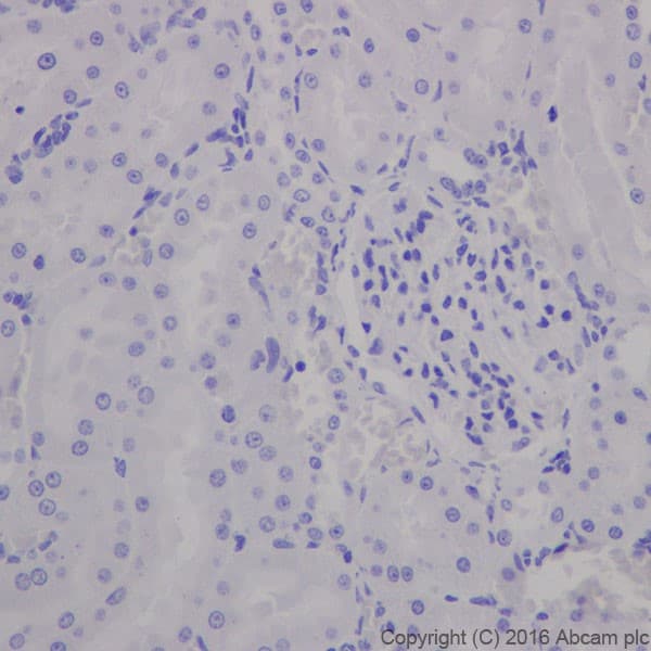 Anti-MAP2 antibody [EPR19691](AB183830)