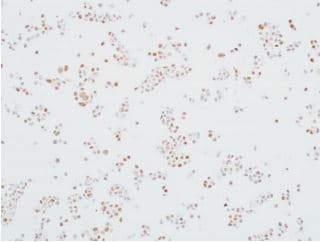 Anti-MED12 antibody [BLR084G](AB275962)