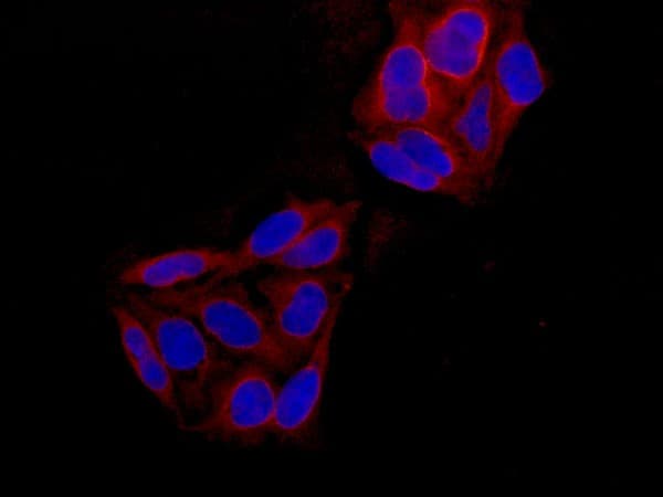 Peroxiredoxin 5 Antibody Epr14528b Bsa And Azide Free Ab250136  Immunocytochemistry Immunofluorescence Img24587