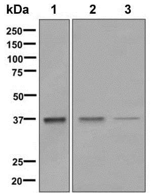 Aldolase Antibody Epr9725 Bsa And Azide Free Ab248965  Western Blot Img126100