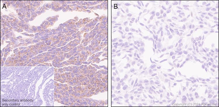 Anti-Slc25a1 antibody [EPR29193-92](AB318201)
