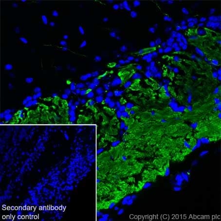 Olfactory Marker Protein Omp Antibody Epr19190 Bsa And Azide Free Ab250712  Immunohistochemistry Frozen Sections Img106750